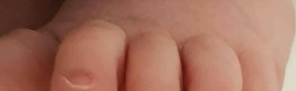 ΕΠΙΣΚΕΠΤΕΣ ΣΕ ΒΡΕΦΟΣ-5 ΕΥΓΕΝΙΚΑ ΜΕΤΡΑ ΑΣΦΑΛΕΙΑΣ